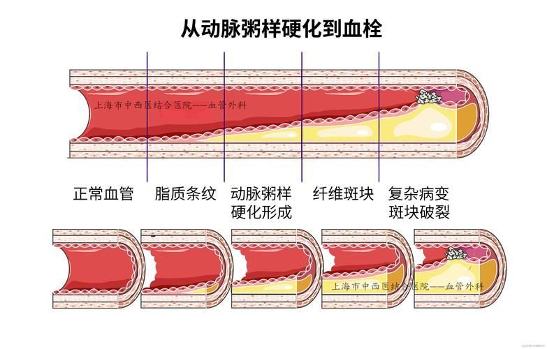 有哪些常見疾病及其防治方法，中國人群高發、具有明確防治路徑的五大類常見疾病
