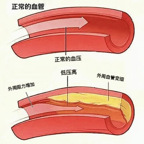 有哪些常見疾病及其防治方法，中國人群高發、具有明確防治路徑的五大類常見疾病