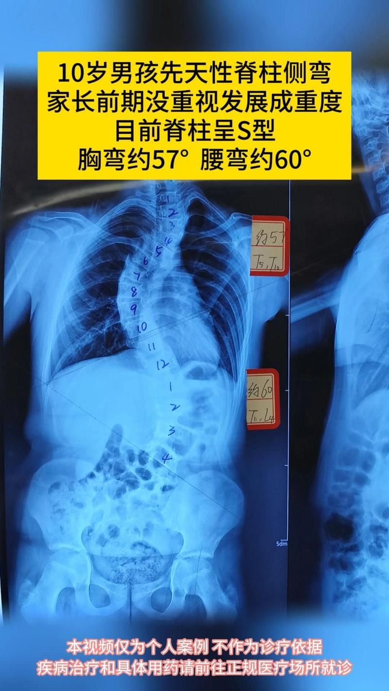 如何判斷龍魚是否營(yíng)養(yǎng)缺乏？，———權(quán)威癥狀圖譜與診斷指南