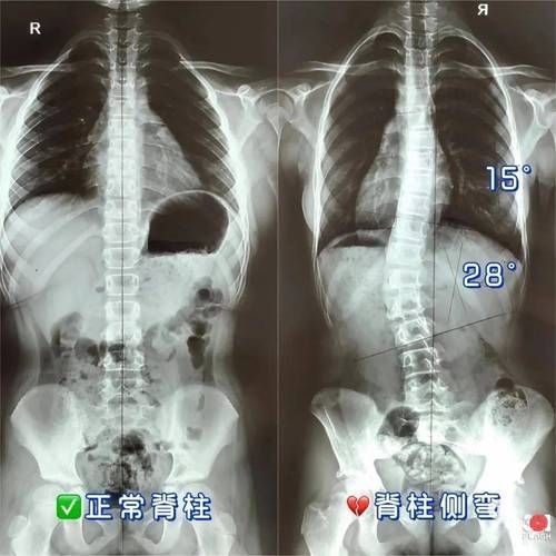 如何判斷龍魚是否營(yíng)養(yǎng)缺乏？，———權(quán)威癥狀圖譜與診斷指南