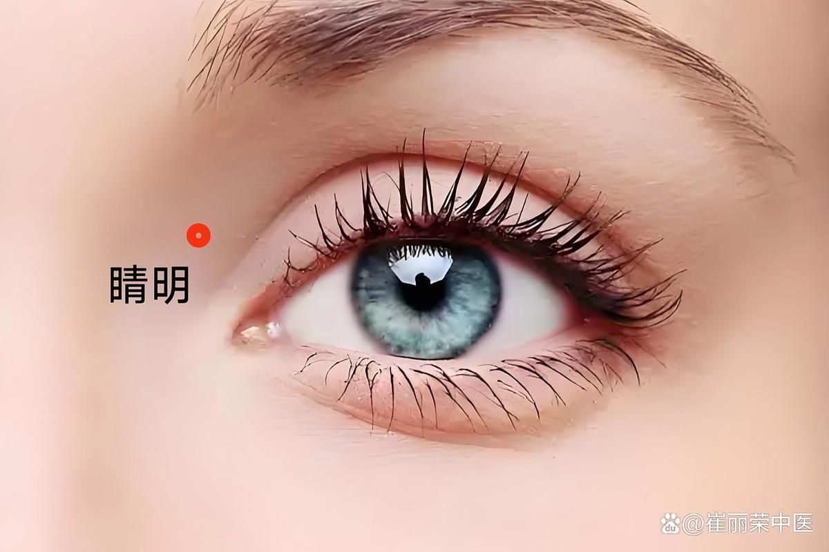 有哪些偏方可以治療氣蒙眼，“氣蒙眼”是民間對“急性青光眼”的俗稱