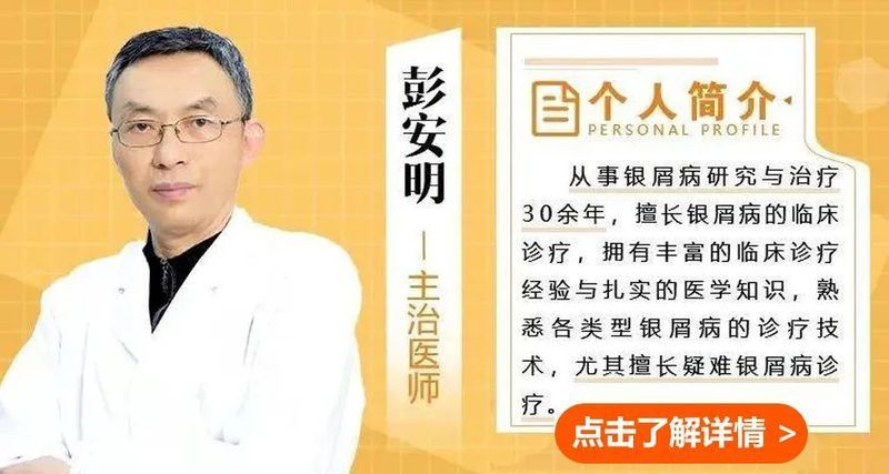 如何判斷松鱗病是否好轉(zhuǎn)