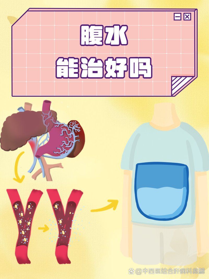腹水病能徹底治愈嗎，腹水病能夠徹底治愈嗎