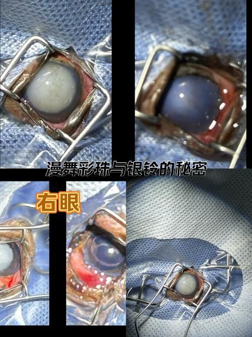 蒙眼病治療需要多長時間，“蒙眼病治療需要多長時間對比圖、角膜炎治療需要多長時間”