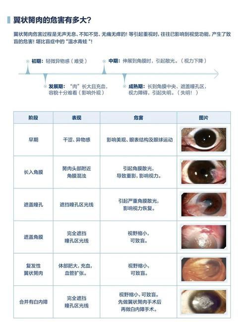 魚突眼最好治療方法