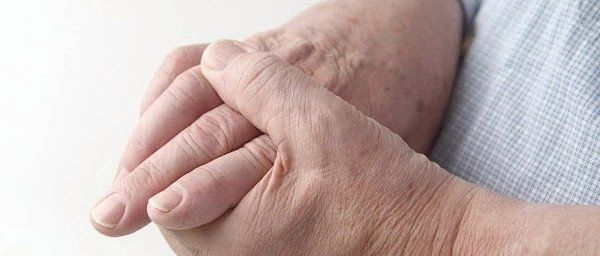 哪些真菌最容易在手上存活，———手癬日常護理清單
