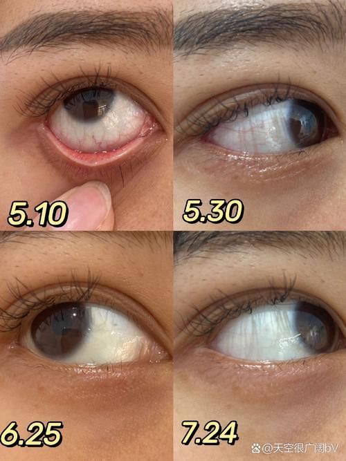 如何區(qū)分紅龍魚眼的好壞，如何區(qū)分紅龍魚的好壞