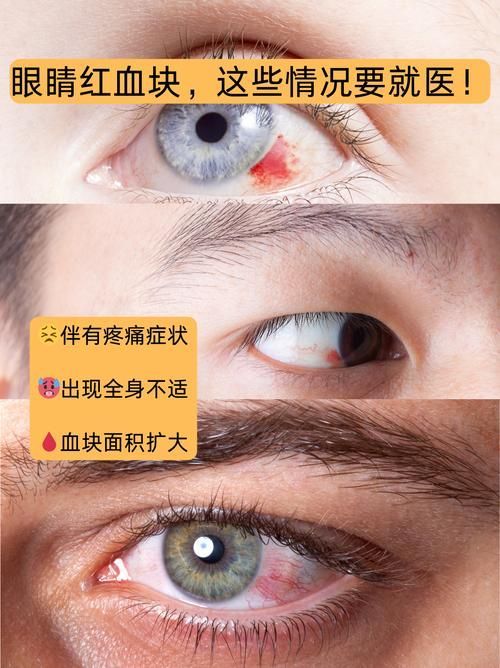 如何區(qū)分紅龍魚眼的好壞，如何區(qū)分紅龍魚的好壞