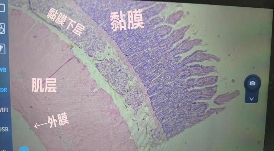 如何預防魚眼白膜的發生，如何預防魚眼白膜
