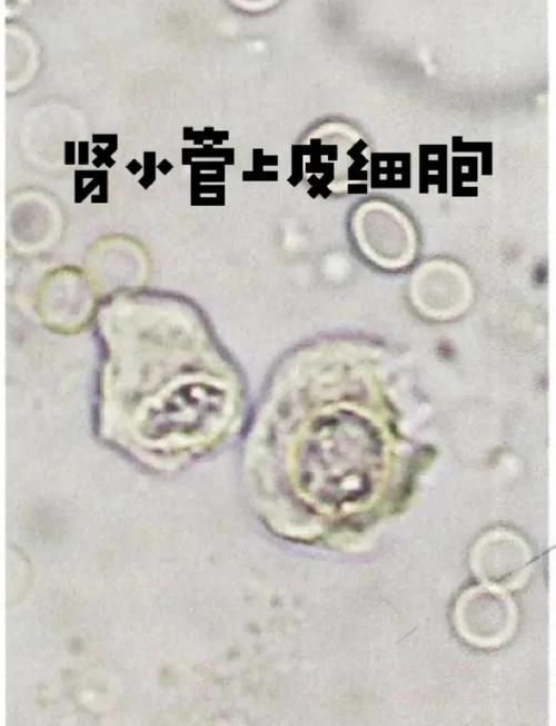 能否詳細解釋病理性膨脹的機制，arxiv論文助手arxiv論文助手arxiv論文助手