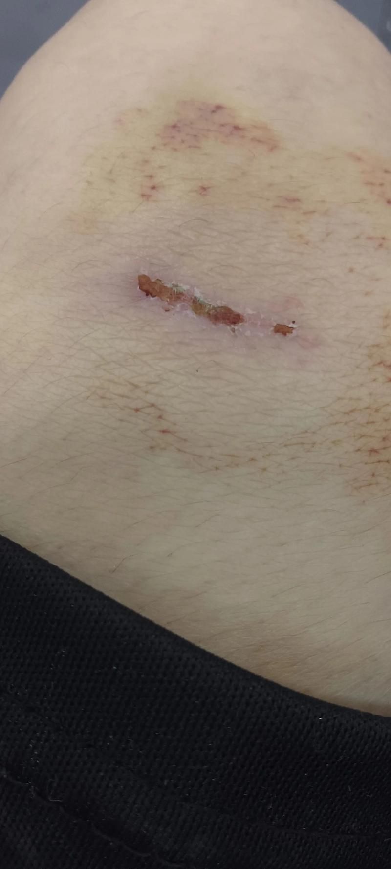 龍魚翻腮手術后如何護理，關于龍魚翻腮手術后護理