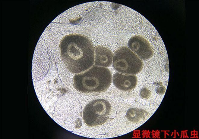金魚寄生蟲有哪些種類，金魚寄生蟲的種類