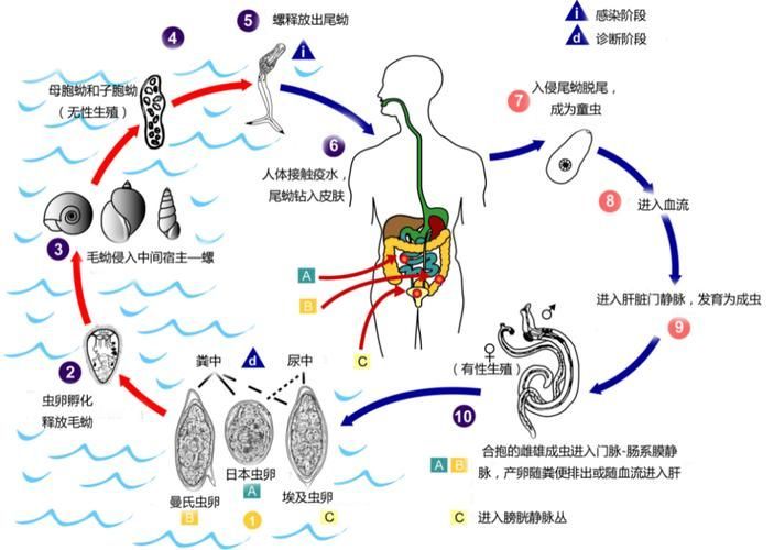 大肚子病如何預防，“大肚子病”在醫學語境中主要指晚期血吸蟲病晚期表現