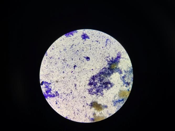 如何預(yù)防魚虱感染，mcp工具arxiv論文助手arxiv論文助手（arxiv論文助手）