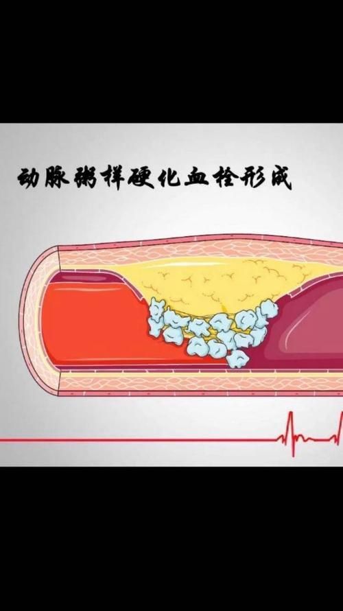 有哪些常見疾病及其防治方法，三甲醫院醫生推薦的高發疾病防治指南（*、百度健康-去問診）
