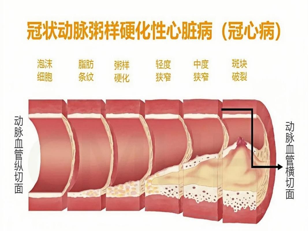 有哪些常見疾病及其防治方法，三甲醫院醫生推薦的高發疾病防治指南（*、百度健康-去問診）