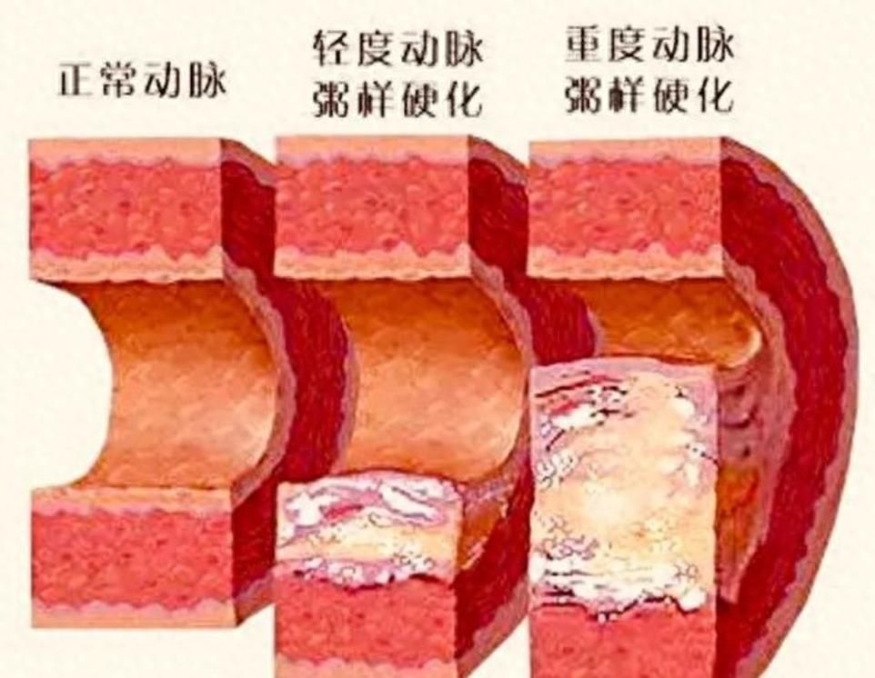 有哪些常見疾病及其防治方法，三甲醫院醫生推薦的高發疾病防治指南（*、百度健康-去問診）