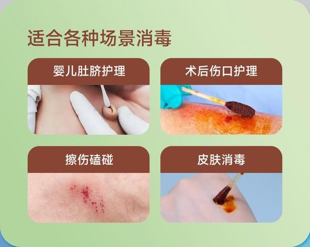 能否提供酒精和碘伏消毒的詳細步驟圖，如何正確使用酒精和碘伏消毒