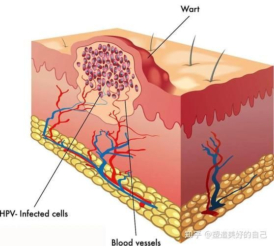 拔鱗后如何護理，arxiv論文助手arxiv論文助手arxiv論文助手