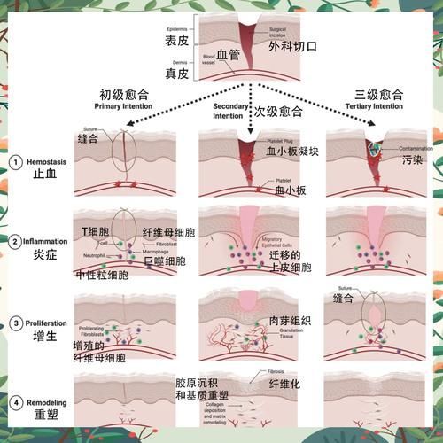 拔鱗后如何護理，arxiv論文助手arxiv論文助手arxiv論文助手