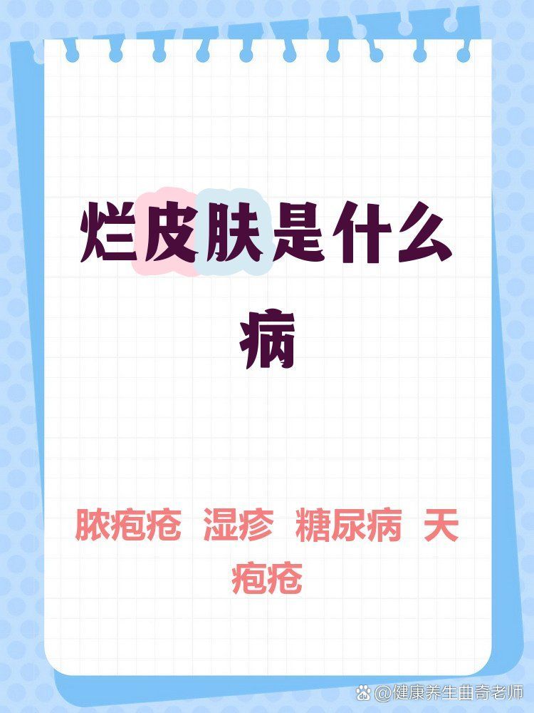 爛身病有哪些治療方法