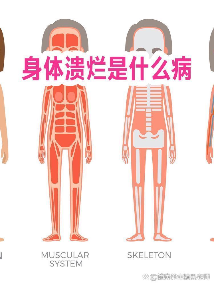 爛身病有哪些治療方法