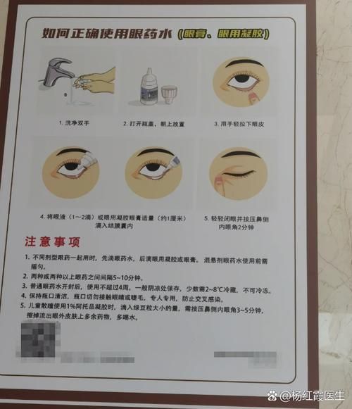 如何緩解蒙眼病的癥狀