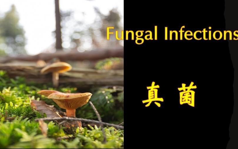 哪些藥物可以有效治療真菌感染，哪些藥物可以治療真菌感染