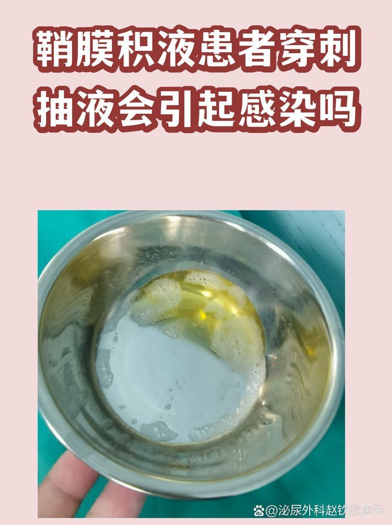 擠壓或穿刺排液有哪些風(fēng)險(xiǎn)，擠壓或穿刺排液有哪些風(fēng)險(xiǎn)擠壓或穿刺排液有哪些風(fēng)險(xiǎn)