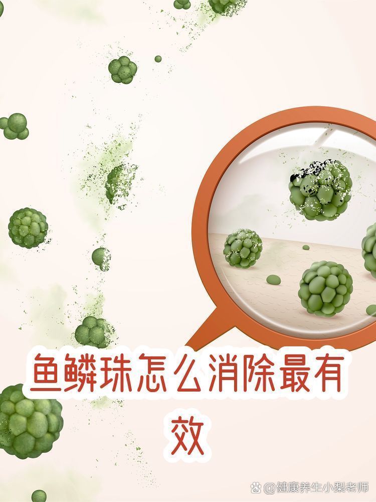 哪種方法去除魚(yú)鱗珠最快，哪種方法去除魚(yú)鱗珠最快本探討了快速去除魚(yú)鱗珠的方法