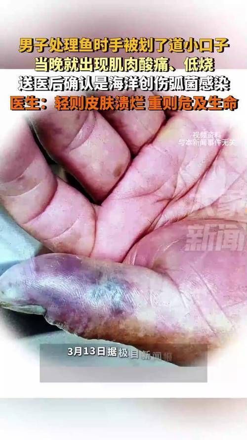 海水魚細菌感染如何治療，海水魚細菌感染如弧菌感染如弧菌感染如弧菌感染