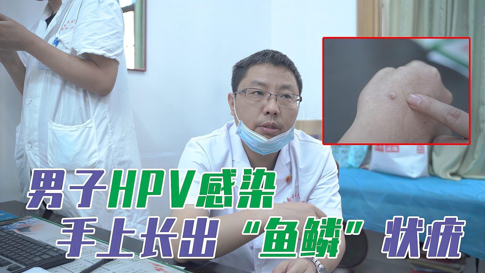 手上長魚鱗會自愈嗎，手上長的魚鱗會自愈嗎