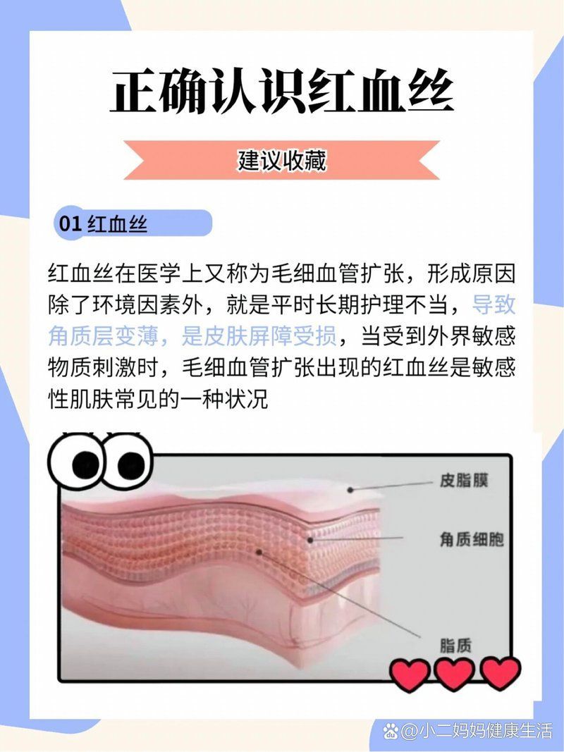 如何判斷自己的紅血絲類型，如何判斷自己的紅血絲類型，如何區(qū)分單純毛細(xì)血管擴(kuò)張和疾病伴隨型