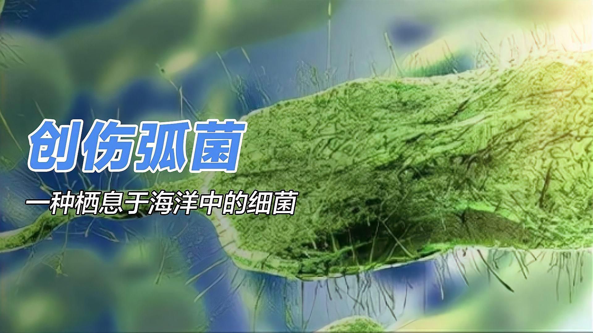 海水細(xì)菌感染的潛伏期是多久，海水細(xì)菌感染的潛伏期