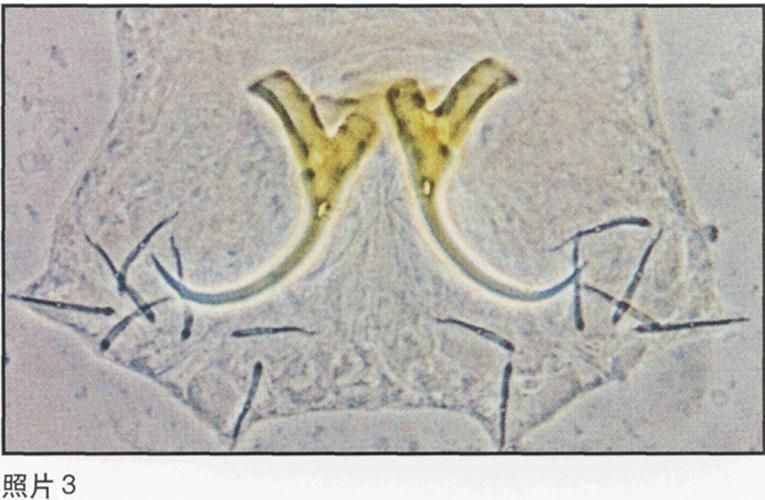 哪種藥物治療龍魚腮寄最有效？，富媒體組件庫召回龍魚腮寄生蟲病治療龍魚腮寄生蟲病