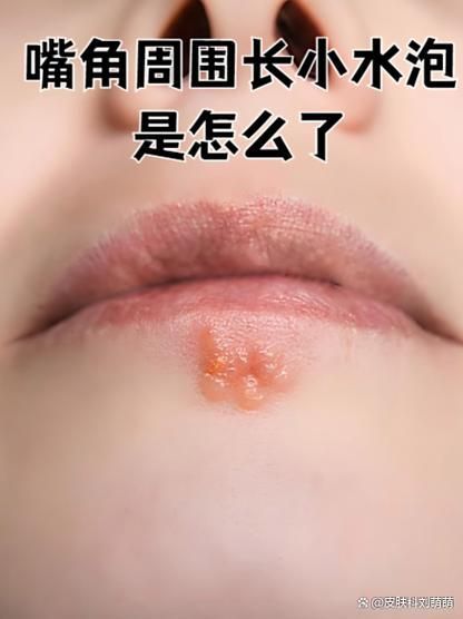 哪些藥物對龍魚嘴角長疙瘩最有效？，龍魚嘴角長疙瘩怎么辦