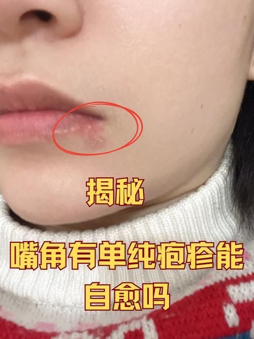 哪些藥物對龍魚嘴角長疙瘩最有效？，龍魚嘴角長疙瘩怎么辦