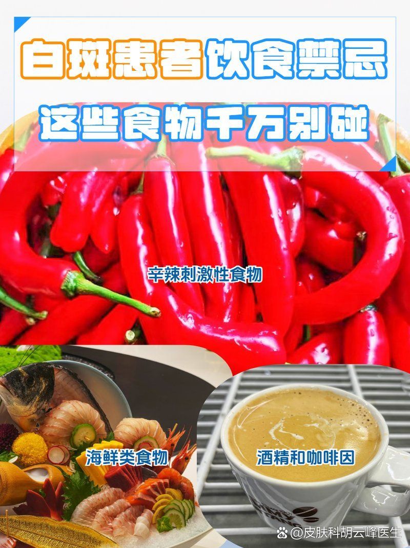 白點病治療期間需要忌口嗎，白點病治療期間需要忌口嗎，白斑患者忌吃什么要注意什么