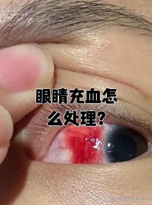 請?zhí)峁┎煌瑖?yán)重程度的充血圖片，如何預(yù)防迷你鸚鵡魚鰭根部充血？