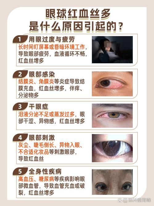 請?zhí)峁┎煌瑖?yán)重程度的充血圖片，如何預(yù)防迷你鸚鵡魚鰭根部充血？