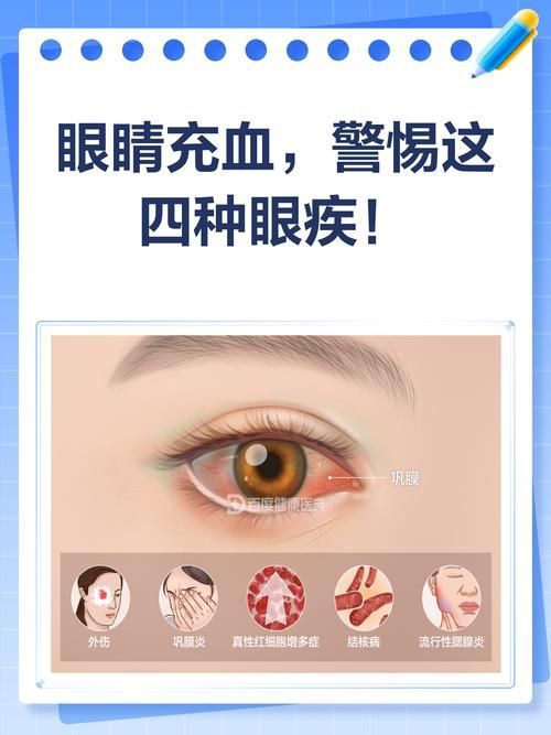 請?zhí)峁┎煌瑖?yán)重程度的充血圖片，如何預(yù)防迷你鸚鵡魚鰭根部充血？