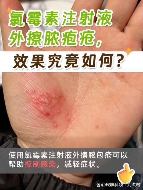 如何區(qū)分龍魚的正常增生和疾病?,如何區(qū)分龍魚正常增生與疾病性增生與疾病性增生形態(tài)