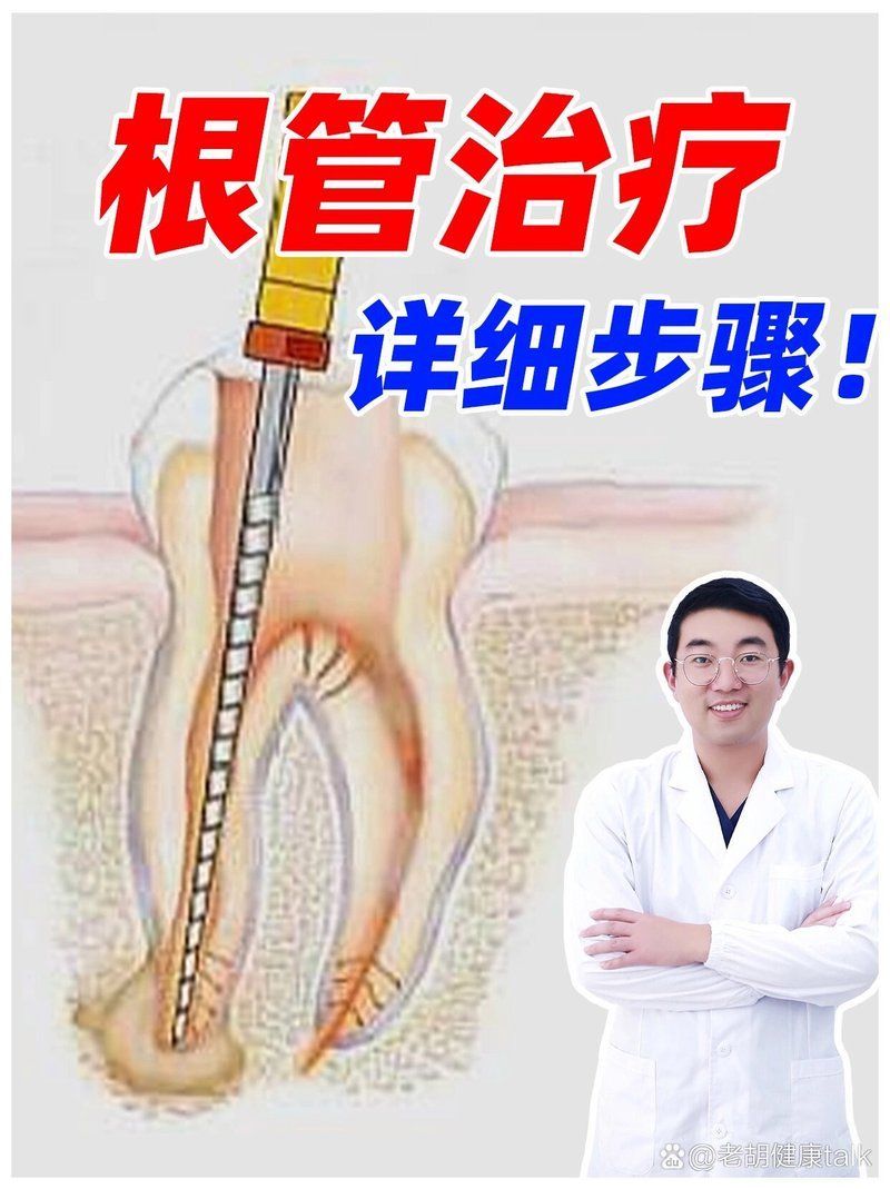 能否提供根管治療的視頻教程，根管治療是針對牙齒病變的一個治療的全過程,你真的了解嗎