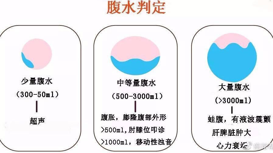 早期腹水病如何治療，早期腹水病治療流程圖
