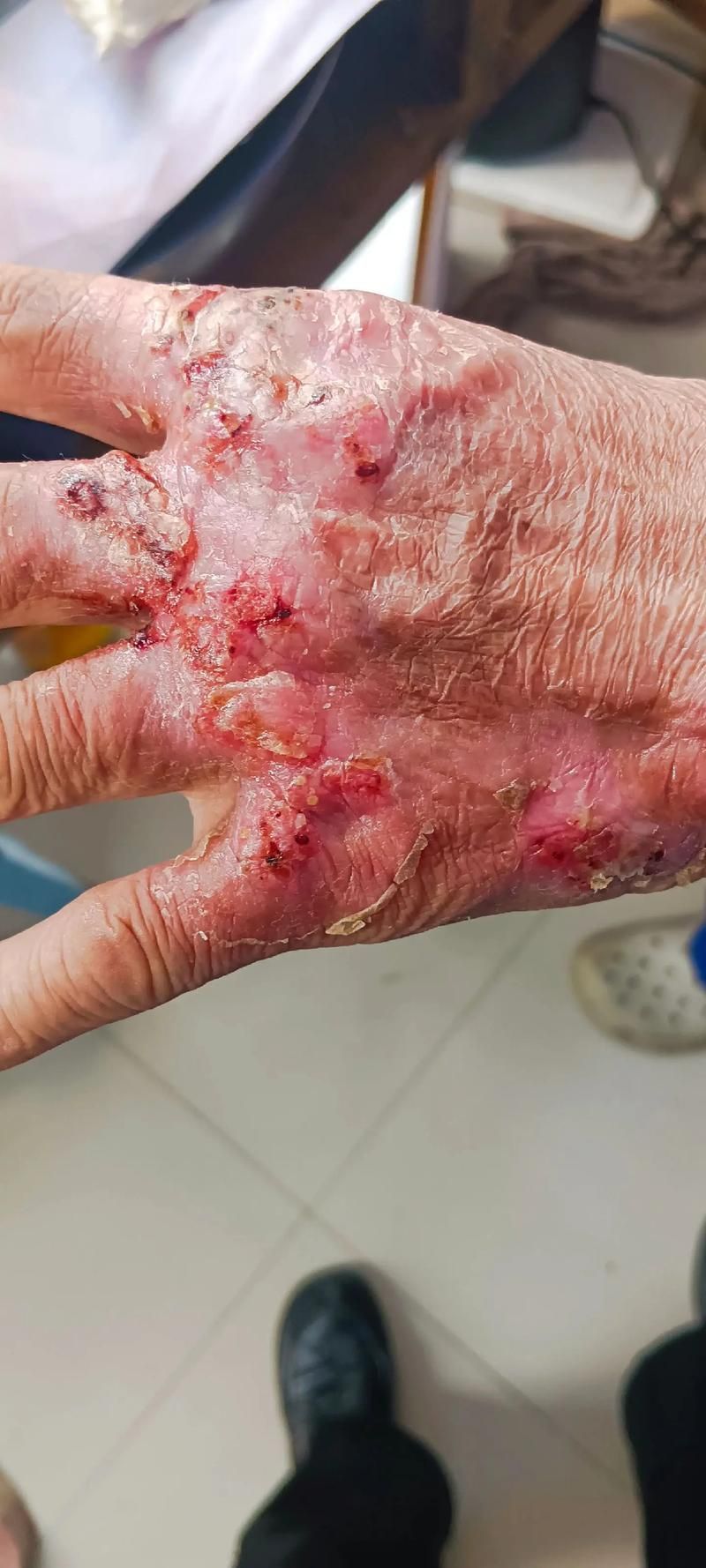 如何判斷龍魚胡子是否齊根斷？，如何判斷龍魚胡子是否“齊根斷”