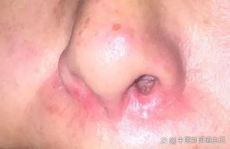 如何判斷非洲象鼻魚是否健康？，如何判斷非洲象鼻魚健康？