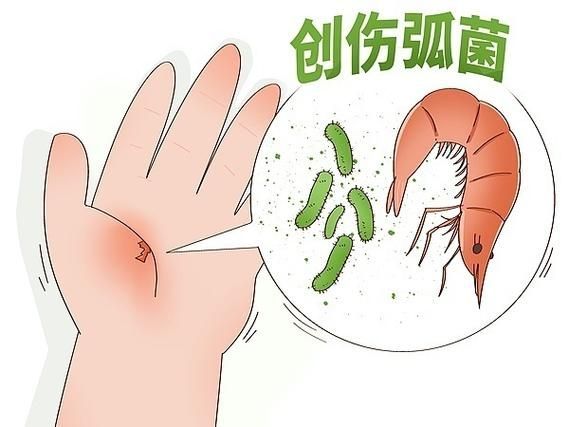 魚類細菌傳染給人的概率有多大，魚類細菌傳播給人類的概率