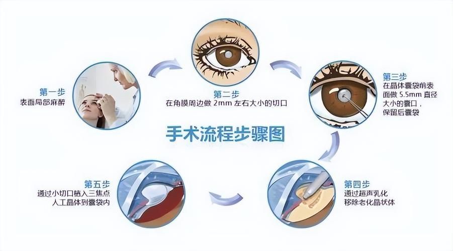蒙眼病如何治療，百度健康-去問診,