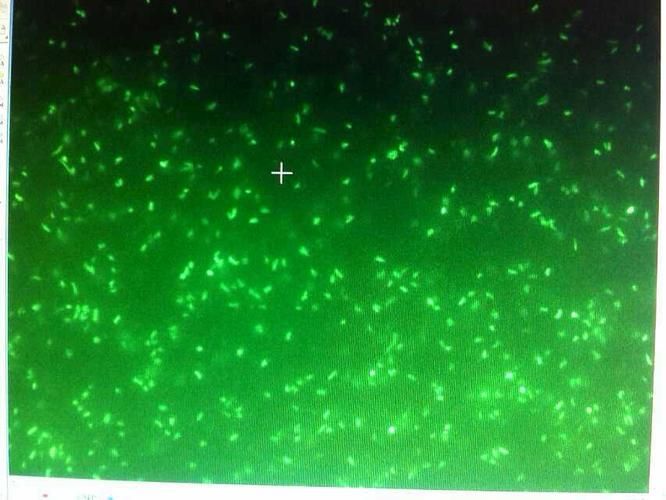 細菌屋清洗后多久會重新菌群，———科學詳解“細菌屋清洗后多久會重新菌群”