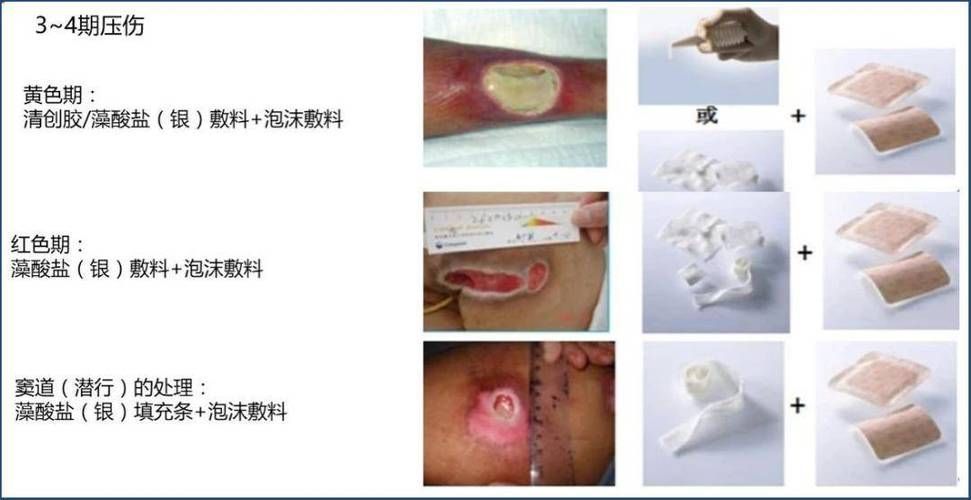 非感染性爛尾如何護(hù)理，“非感染性爛尾”如何護(hù)理